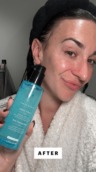 Wohlner after applying the SkinCeuticals Simply Clean Cleanser